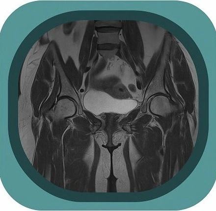 mri pelvis  anatomy icon